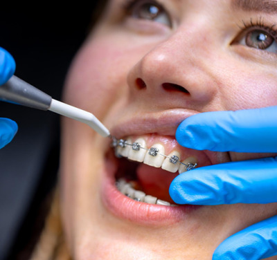 Ортодонтия